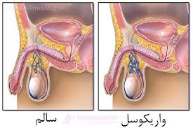 معجون واریکوسل وارداتی/ 1 کیلو طب سنتی هندی ایرانی ترکیب 16 گیاه + 50گرم ژل رویال1 کیلو